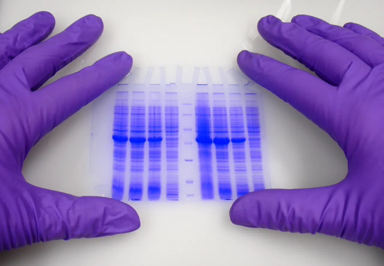 Purple gloves examining a gel electrophoresis