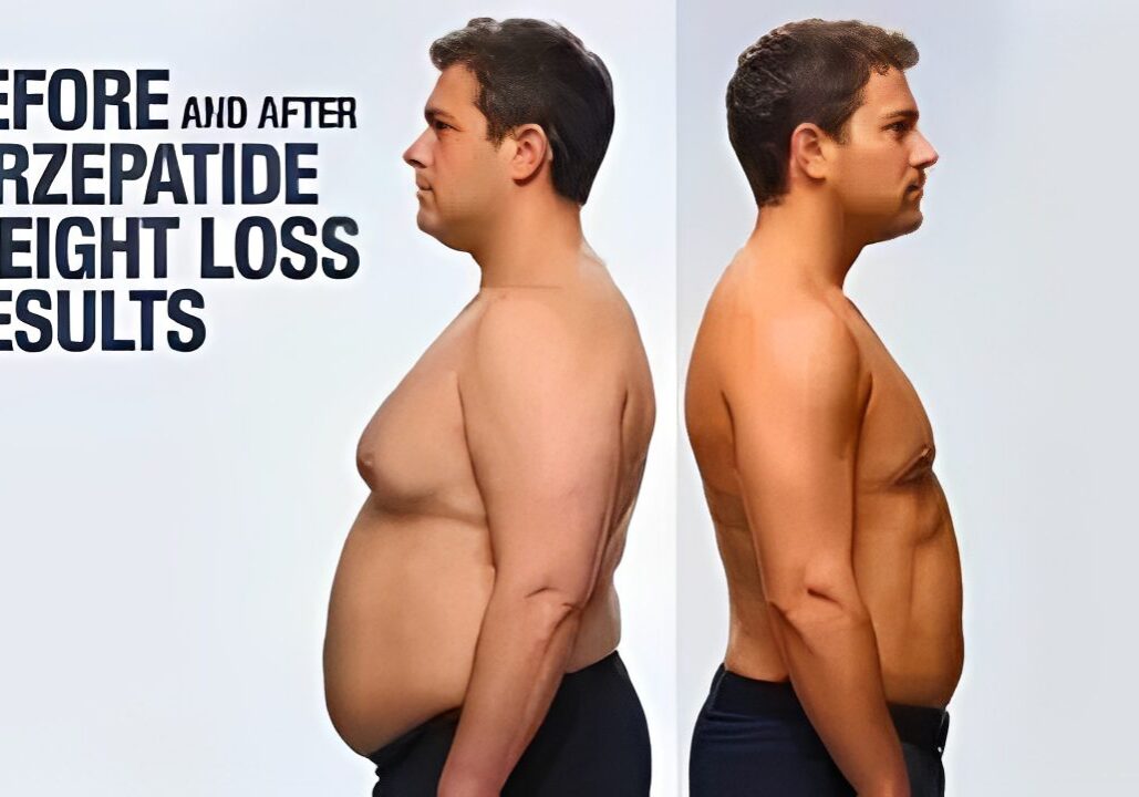 Tirzepatide weight loss comparison